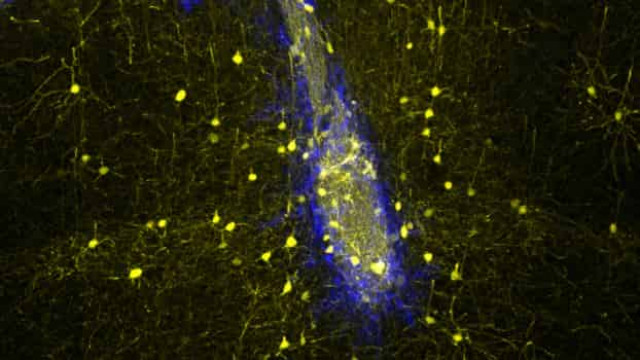 Пересаженные нейроны встроились в мозг

