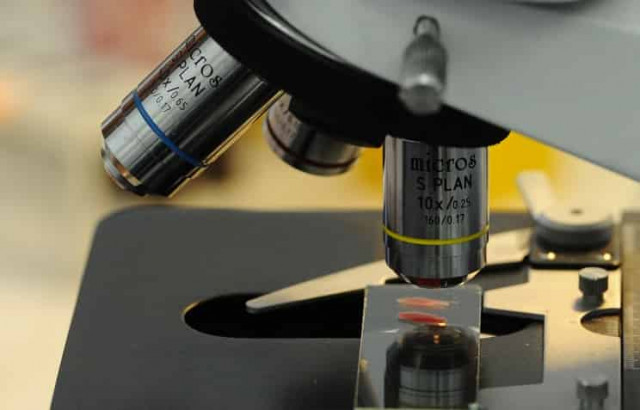 Ученые: длительное пребывание в космосе ослабляет работу иммунной системы