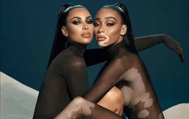 Горячие фото - Кардашьян снялась с известной моделью с витилиго