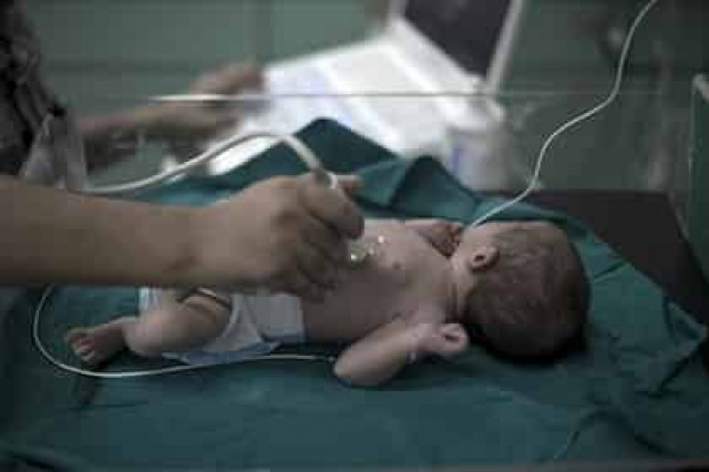 Пересадка матки от бабушки младенца впервые привела к успешным родам
