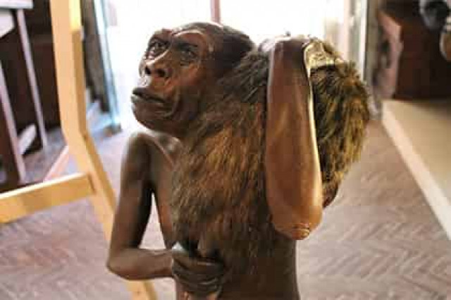 «Человек-хоббит» на самом деле страдал от синдрома Дауна