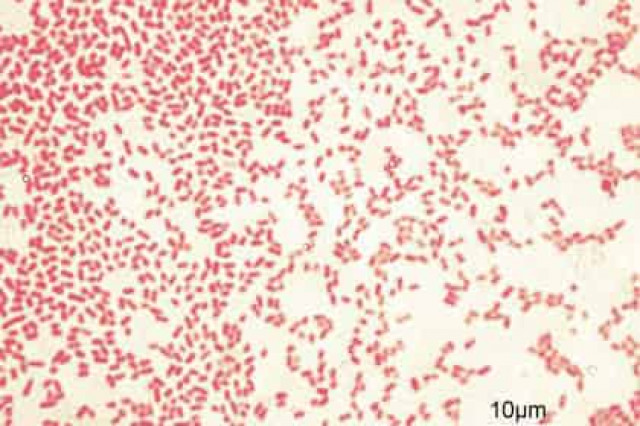 Глобальная опасность неуязвимых к антибиотикам микробов подтвердилась