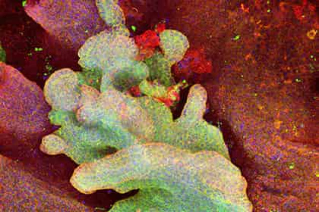 Объяснена смертоносность раковых клеток