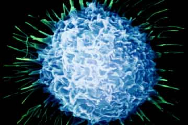 Рак и синдром Альцгеймера