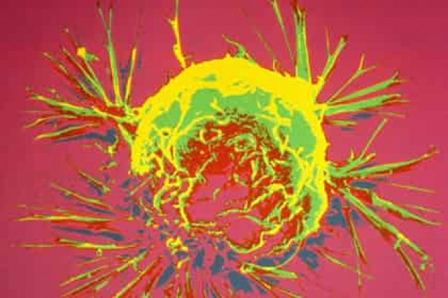 Развитие рака связали с «могучим» храпом