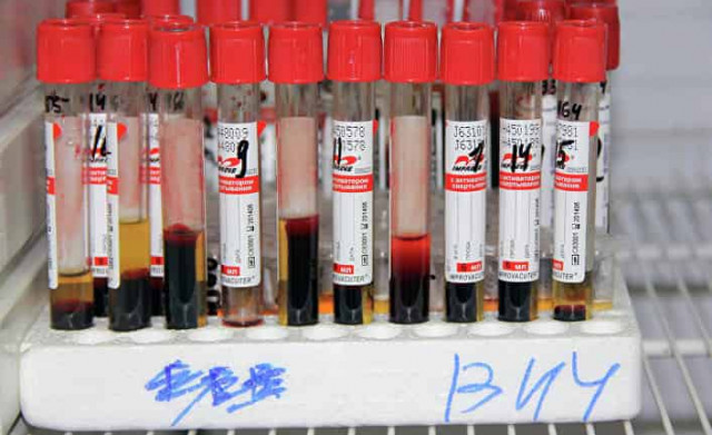 Датчане — впереди всех в поисках лекарства от ВИЧ