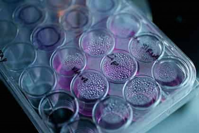 Математики научили врачей бороться с раком