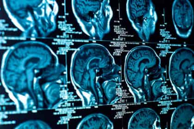 У финансово успешных людей обнаружена физиологическая особенность