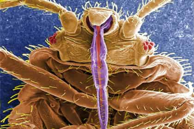 Названа опасность постельного белья
