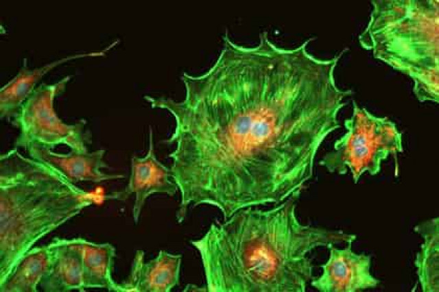 Нейробиологи объяснили «расширенное сознание» под ЛСД