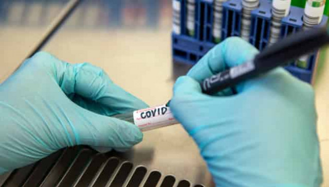 Five new coronavirus cases recorded in Ukrainian army