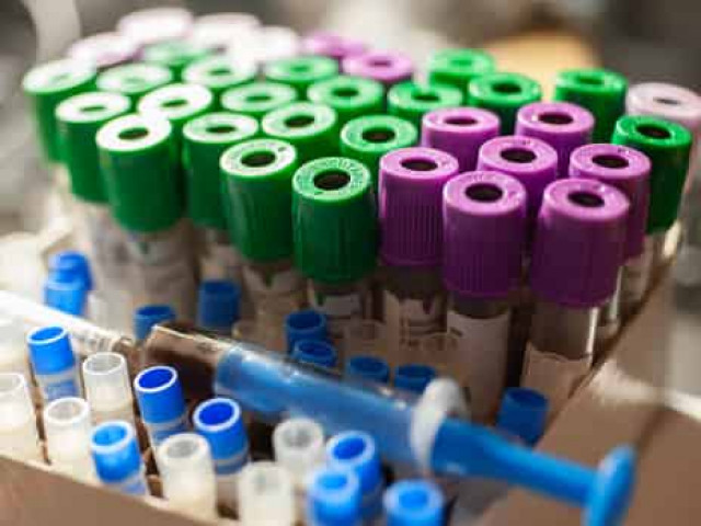 Число заболевших COVID-19 в мире превысило 8 млн