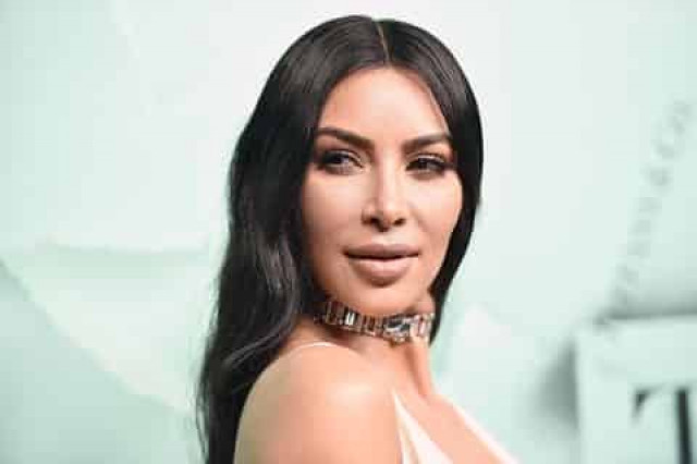 Kim Kardashian tells about her excruciating recovery after childbirth (PHOTOS)