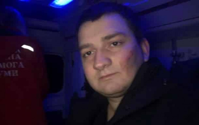 Нардеп от Слуги народа заявил о нападении на него