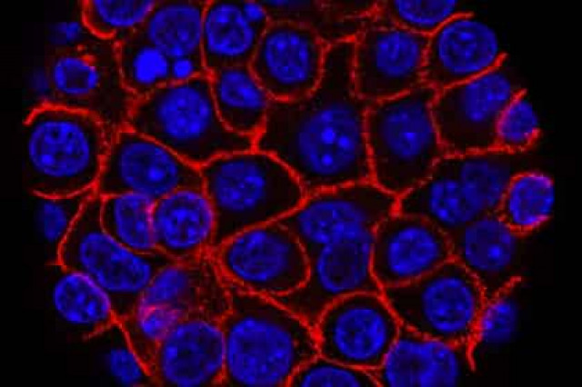 Найден способ победить бессмертные раковые клетки
