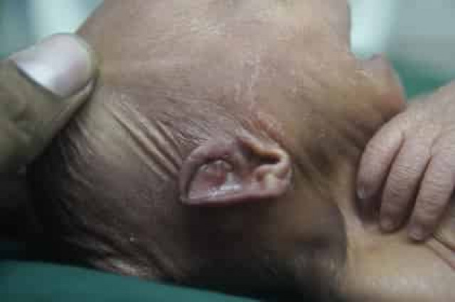 Выявлен неожиданный способ победить преждевременное старение
