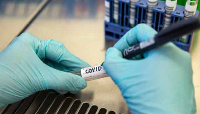 Ukrainian army reports 39 coronavirus cases