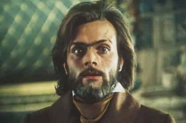 Звезда «Овода» экстренно госпитализирован в Москве
