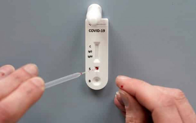 Ученые подтвердили связь между группой крови и тяжестью коронавируса