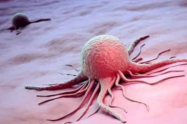 Найден способ избежать особо опасного рака
