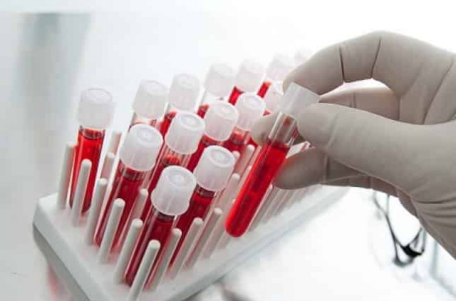 Ученые разработали анализ крови, который сможет предсказать смерть в ближайшие 10 лет
