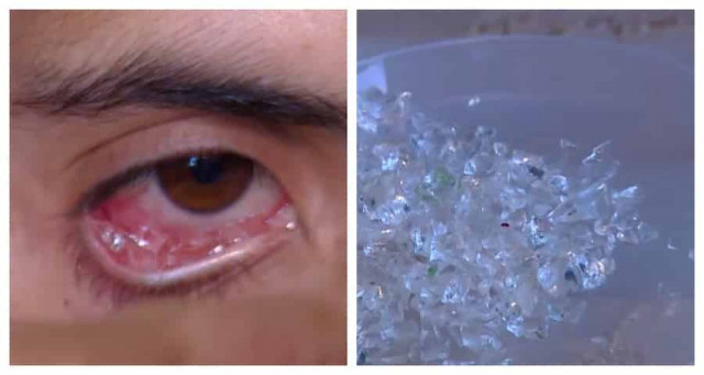 «Каждый день превратился в ад»: девушка плачет кристаллами вместо слез