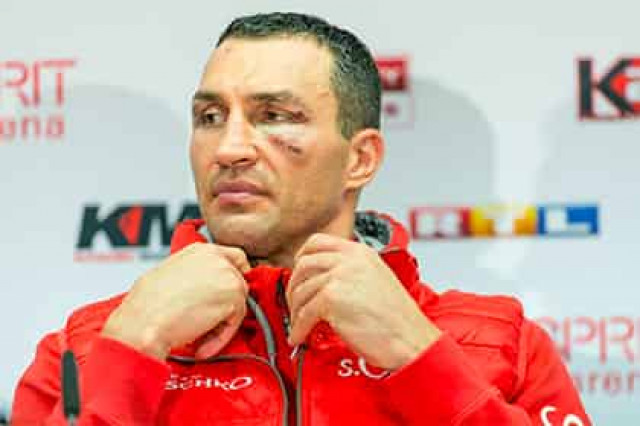 Кличко рассказал о радости поражения в бою с Фьюри
