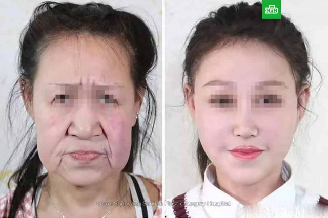 15-летняя китаянка была похожа на старушку