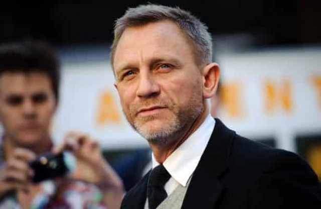 Главному актеру «Агент 007» сделают операцию