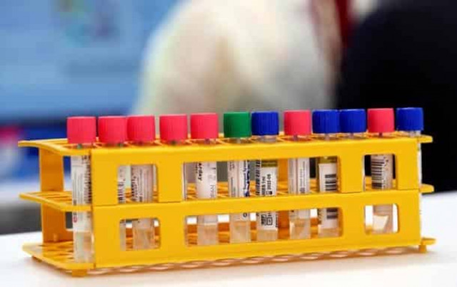 В Крыму всплеск заражения коронавирусом