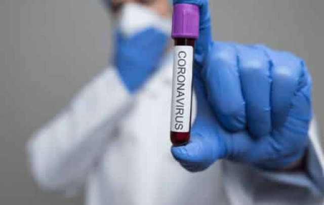 Armenia confirms 452 new coronavirus cases in past day