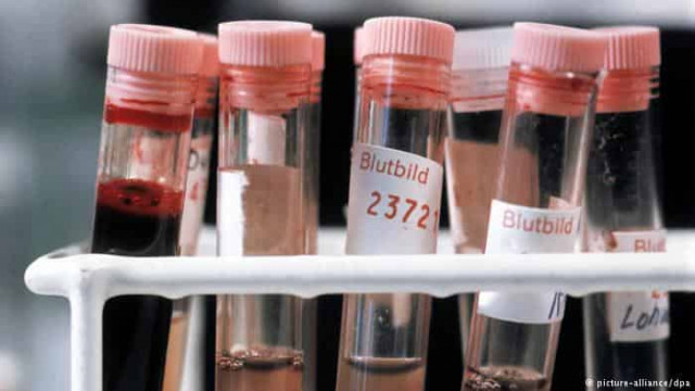 В Германии разработали новый метод диагностики рака груди