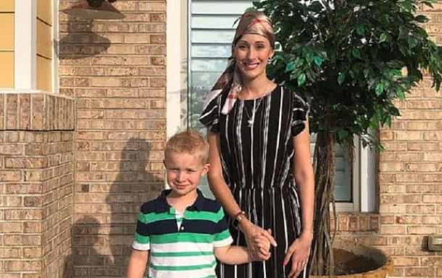 Экс-королева красоты осталась без половины черепа (ФОТО)