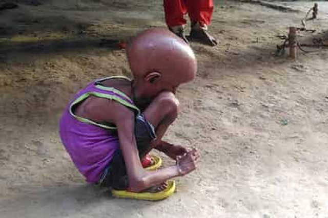 Найден способ затормозить преждевременное старение
