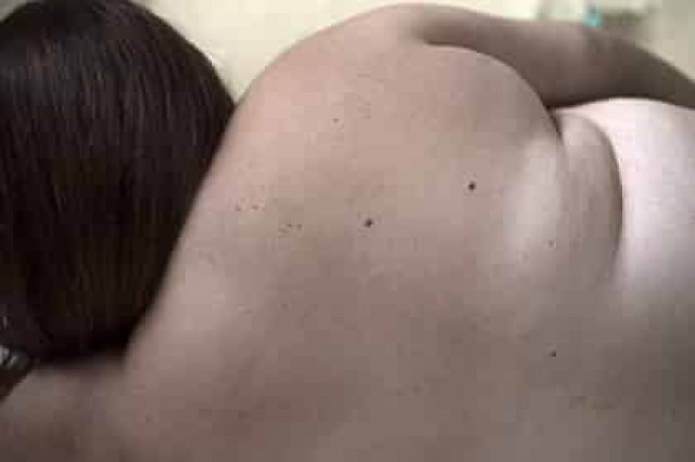 Недостаток микробов назвали причиной ожирения