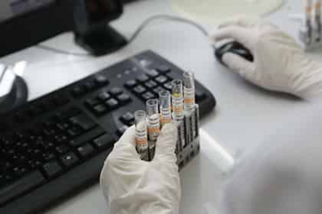 В РУСАДА назвали слова о системе допинга в России вырванными из контекста