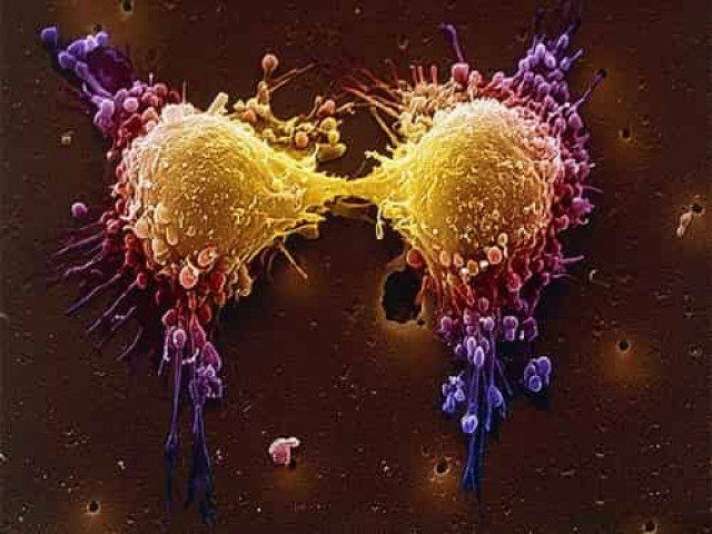 Ученые обратили вспять процесс канцерогенеза