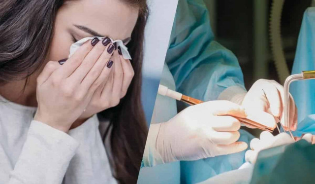 Лікарі під час операції забули у жінці предмет розміром з тарілку, вона могла померти
