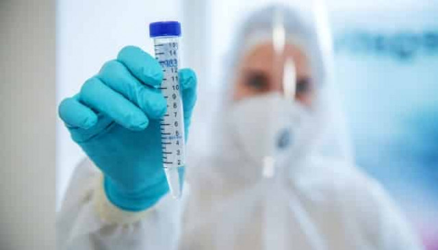 Ukrainian army reports 121 new coronavirus cases