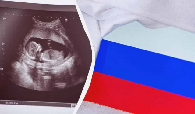 У Росії стали частіше робити аборти і розлучатися
